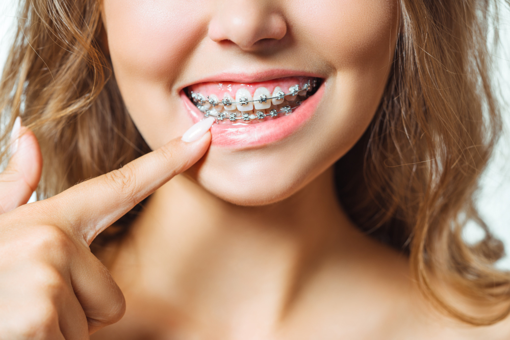 Orthodontics Services